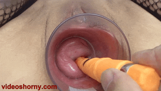 Extreme gaping cervix with big dildo