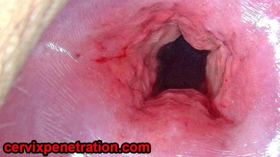 Uterus Dilation with Penetration and Cervix Stretching